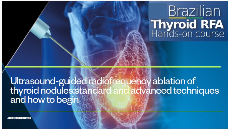 Εκπαίδευση στην υπερηχογραφικά καθοδηγούμενη θερμοκατάλυση (State University of Rio de Janeiro (UERJ))